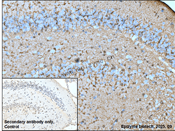 Anti-Glutamine Synthetase Rabbit mAb [72M39L80]