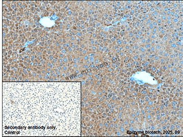 Anti-Glutamine Synthetase Rabbit mAb [72M39L80]