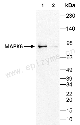 Anti-MAPK6 Rabbit mAb [45L18K54]