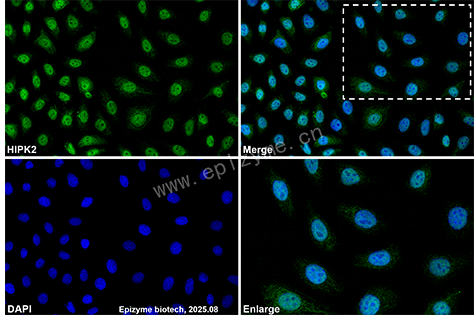 Anti-HIPK2 Rabbit mAb [72L03M14]