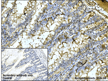 Anti-IL-11 Receptor alpha Rabbit mAb [53L49M67]