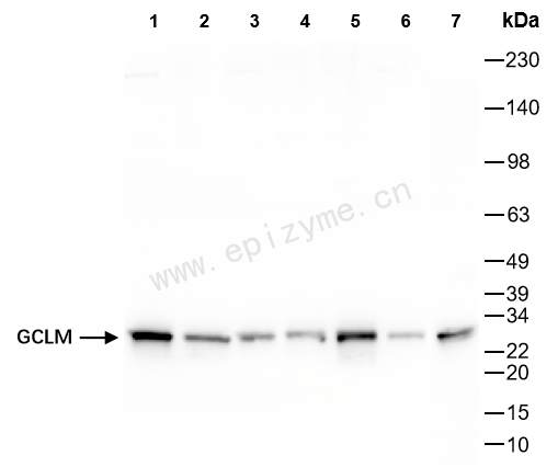 Anti-GCLM Rabbit mAb [79H09H28]