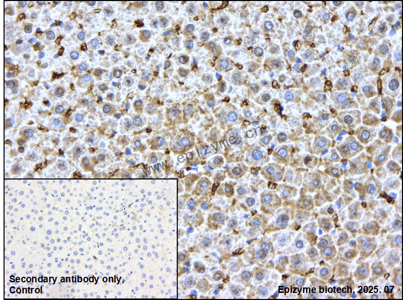 Anti-GCLM Rabbit mAb [79H09H28]