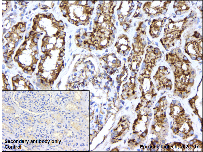 Anti-GCLM Rabbit mAb [79H09H28]