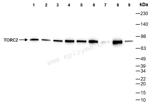 Anti-TORC2 Rabbit mAb [15N86K68]