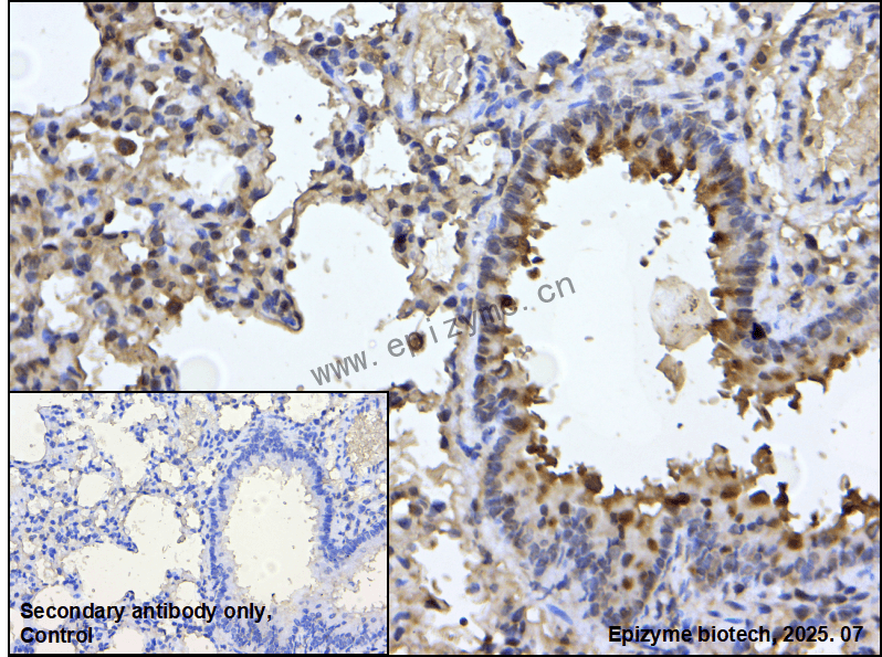 Anti-TORC2 Rabbit mAb [15N86K68]