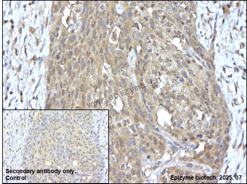 Anti-TORC2 Rabbit mAb [15N86K68]