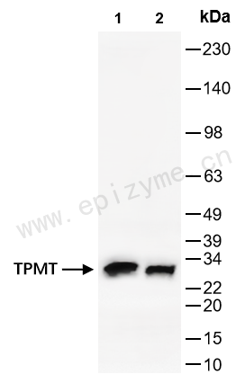 Anti-TPMT Rabbit mAb [91P19N26]
