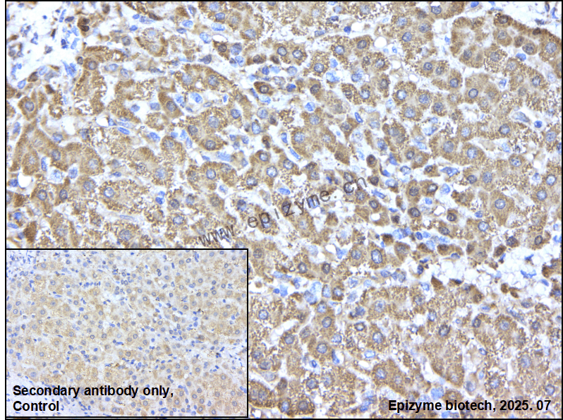 Anti-TPMT Rabbit mAb [91P19N26]