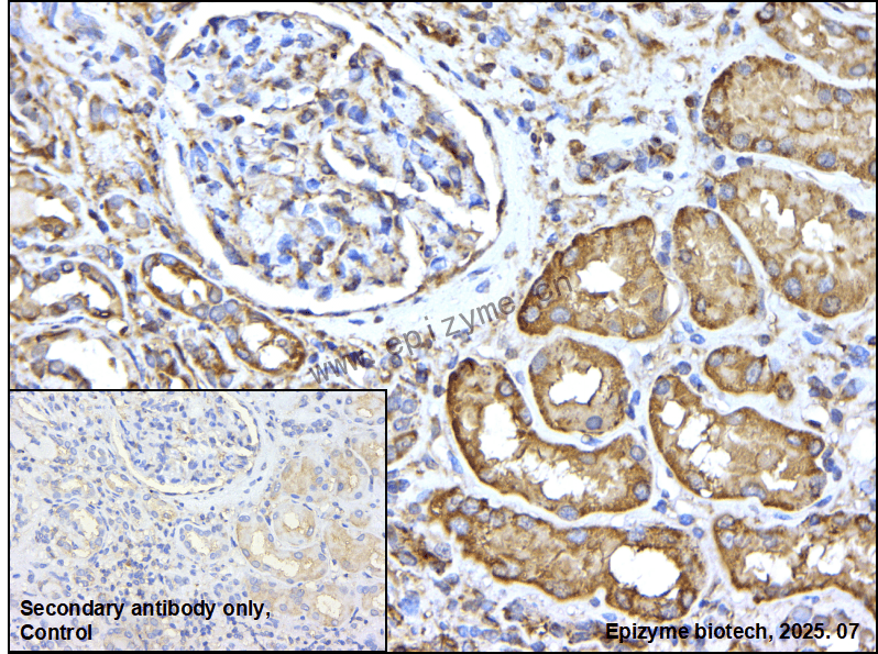 Anti-TPMT Rabbit mAb [91P19N26]