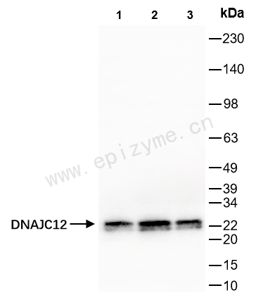 Anti-DNAJC12 Rabbit mAb [47S44B66]