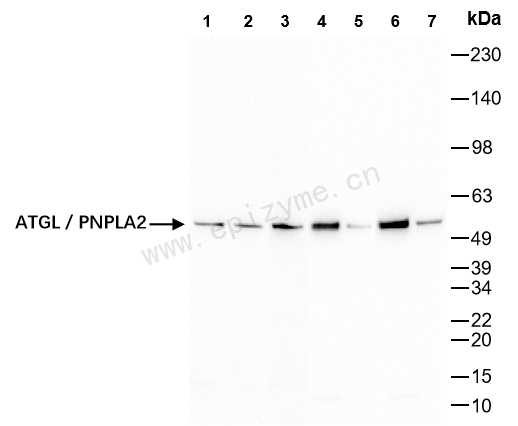 Anti-Adipose Triglyceride Lipase Rabbit mAb [70E93R91]