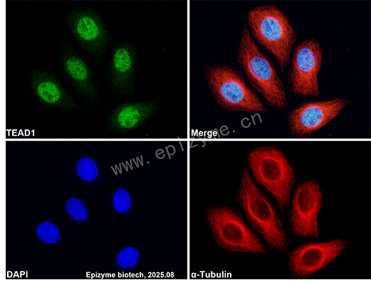 Anti-TEF1/TEAD-1 Rabbit mAb [96T89H01]