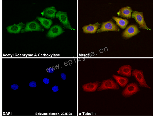 Anti-Acetyl Coenzyme A Carboxylase Rabbit mAb [73D41S82]