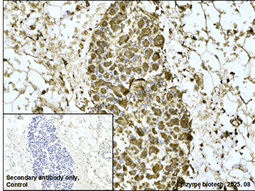 Anti-Acetyl Coenzyme A Carboxylase Rabbit mAb [73D41S82]
