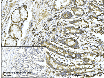 Anti-Acetyl Coenzyme A Carboxylase Rabbit mAb [73D41S82]