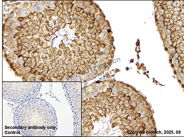 Anti-Glutathione Peroxidase 4 Rabbit mAb [75P49J64]
