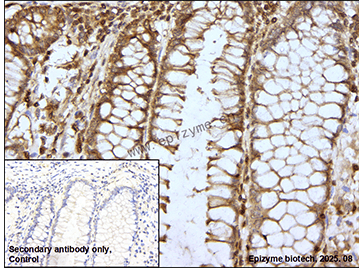 Anti-Glutathione Peroxidase 4 Rabbit mAb [75P49J64]