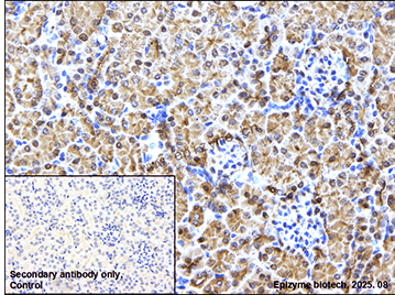 Anti-Glutathione Peroxidase 4 Rabbit mAb [75P49J64]