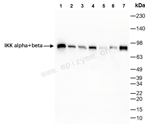 Anti-IKK alpha/beta Rabbit mAb [17M47N00]