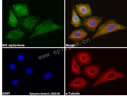 Anti-IKK alpha/beta Rabbit mAb [17M47N00]