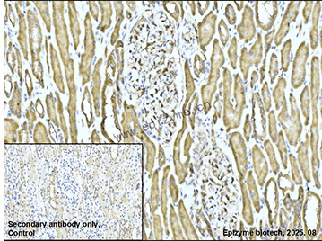 Anti-IKK alpha/beta Rabbit mAb [17M47N00]
