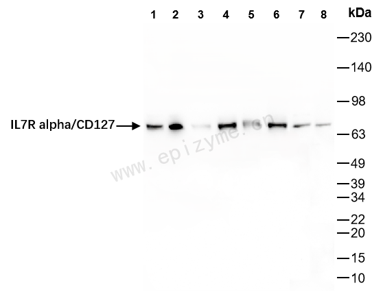 Anti-CD127 Rabbit mAb [70N09N49]