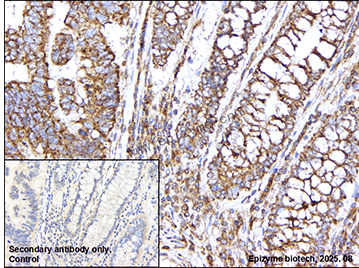 Anti-CD127 Rabbit mAb [70N09N49]