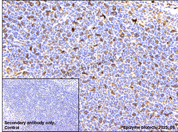 Anti-CD127 Rabbit mAb [70N09N49]