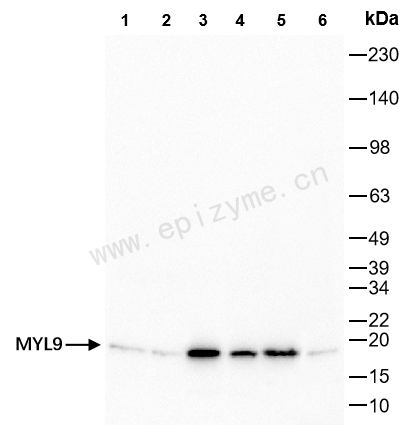Anti-MYL9 Rabbit mAb [17H38S76]
