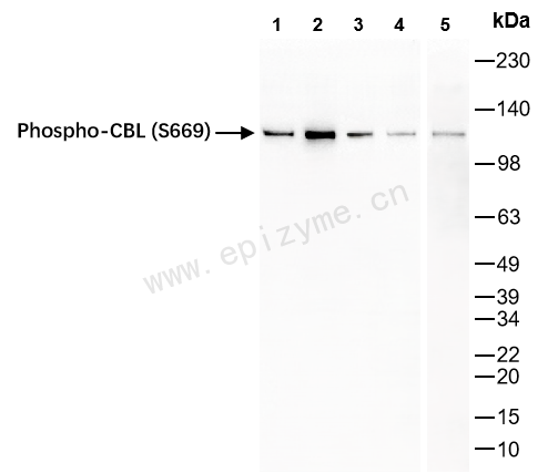 Anti-Phospho-CBL (Ser669) Rabbit mAb [95S60K95]