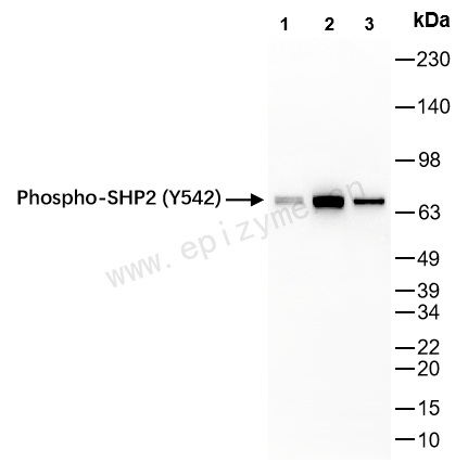 Anti-Phospho-SHP2 (Tyr542) Rabbit mAb [79L37A28]