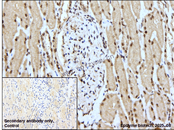 Anti-Phospho-SHP2 (Tyr542) Rabbit mAb [79L37A28]