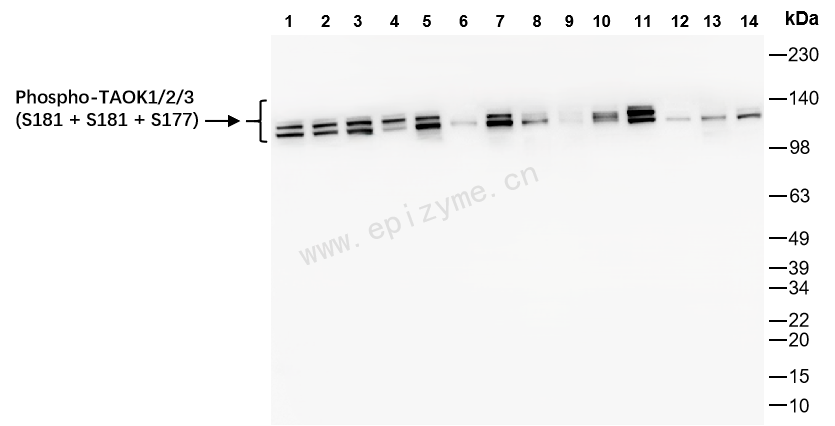 Anti-Phospho-TAOK1/2/3 (Ser181/Ser181/Ser177) Rabbit mAb [58A29J28]