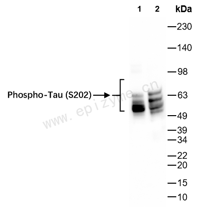 Anti-Phospho-Tau (Ser202) Rabbit mAb [27K33P39]