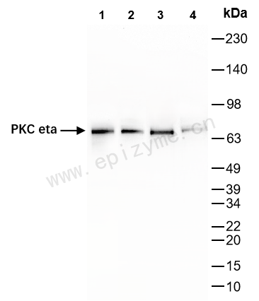 Anti-PKC eta Rabbit mAb [62H05Q98]