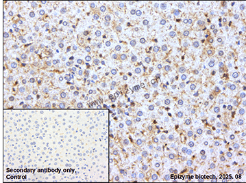 Anti-PKC eta Rabbit mAb [62H05Q98]