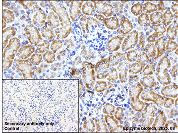 Anti-PKC eta Rabbit mAb [62H05Q98]