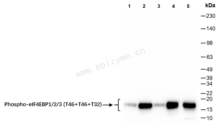 Anti-Phospho-4E-BP1/2/3 (Thr46/Thr46/Thr32) Rabbit mAb [77D30C09]