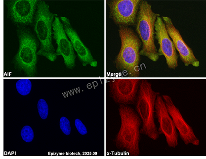 Anti-AIF Rabbit mAb [27J78L50]