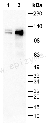 Anti-Phospho-FAK (Tyr925) Rabbit mAb [61J98N61]