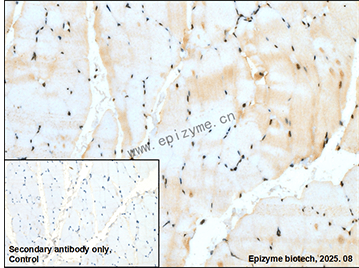 Anti-Phospho-FAK (Tyr925) Rabbit mAb [61J98N61]