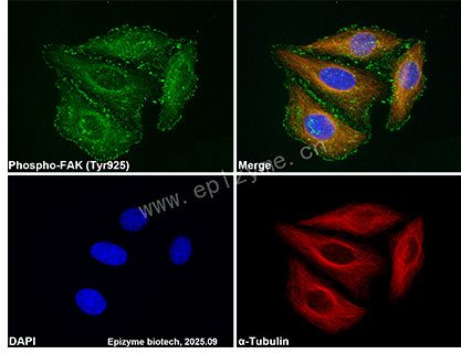 Anti-Phospho-FAK (Tyr925) Rabbit mAb [61J98N61]
