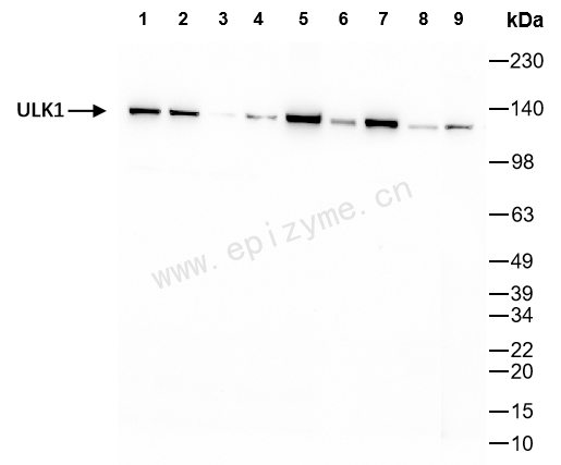 Anti-ULK1 Rabbit mAb [67M08P00]