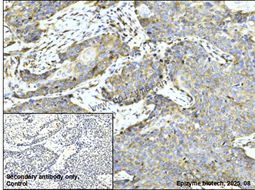 Anti-ULK1 Rabbit mAb [67M08P00]