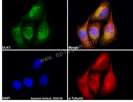 Anti-ULK1 Rabbit mAb [67M08P00]