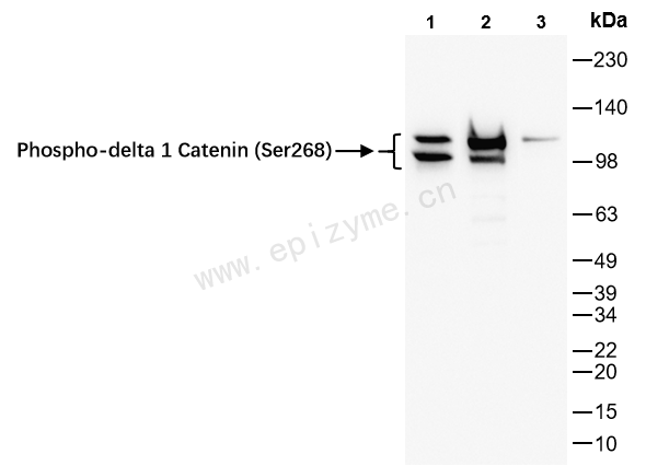 Anti-Phospho-delta 1 Catenin (Ser268) Rabbit mAb [22K60K45]