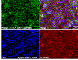 Anti-Phospho-delta 1 Catenin (Ser268) Rabbit mAb [22K60K45]