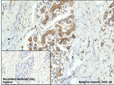 Anti-Phospho-delta 1 Catenin (Ser268) Rabbit mAb [22K60K45]