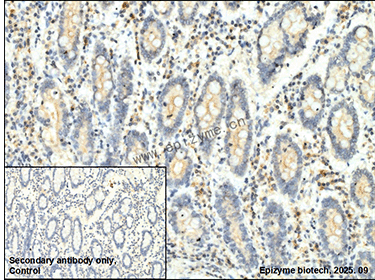 Anti-Phospho-delta 1 Catenin (Ser268) Rabbit mAb [22K60K45]
